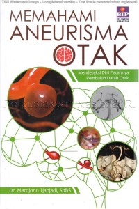 Memahami Aneurisma Otak